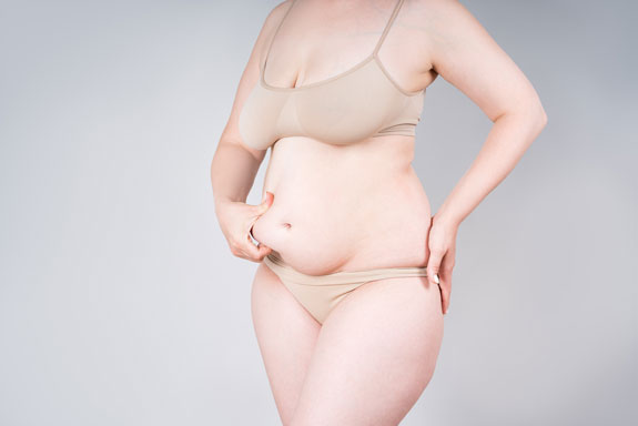 Bauchdeckenstraffung Bad Dürkheim Bauchdeckenstraffung Bad Dürkheim